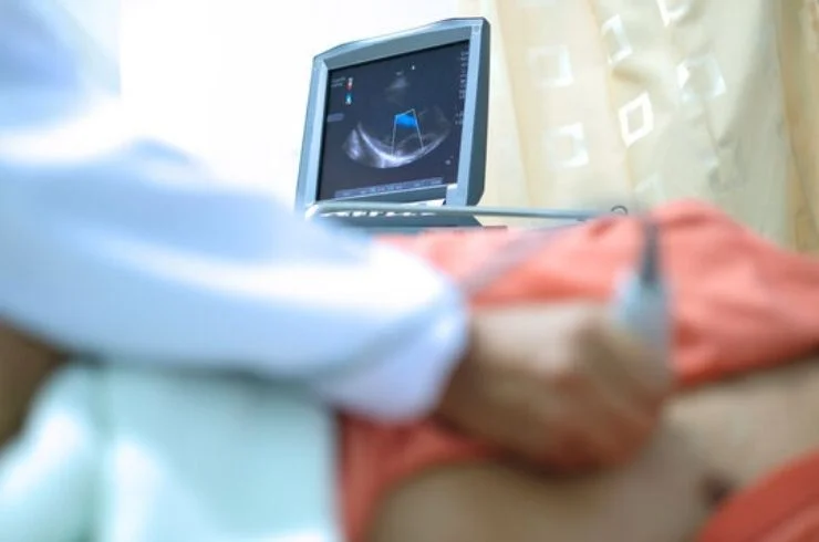 Echocardiography