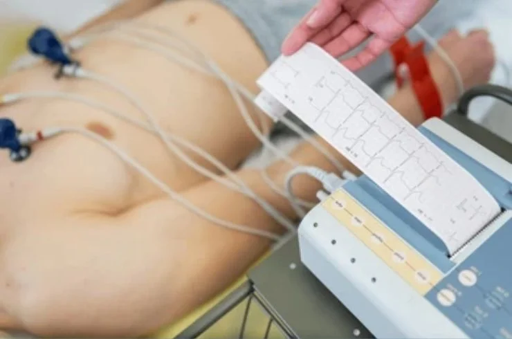 Electrocardiogram (ECG or EKG)